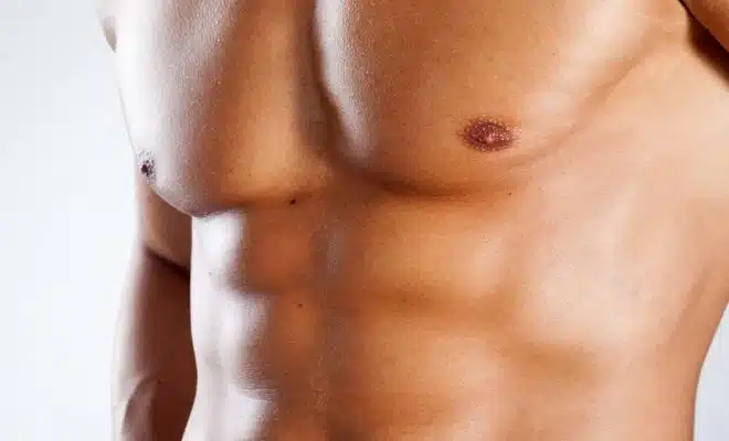 Tout savoir sur la liposuccion de la poitrine chez les hommes