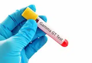 choisir la bonne plante pour réduire les gamma gt
