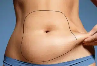 meilleur pays pour faire une liposuccion