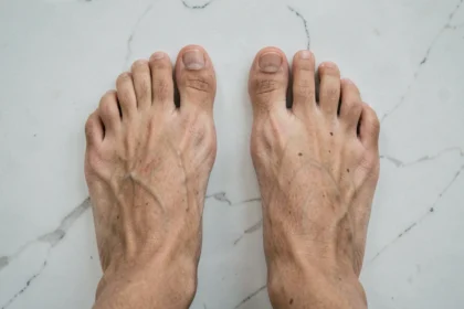 Comparaison entre un pied égyptien et un pied grec posés côte à côte sur marbre blanc